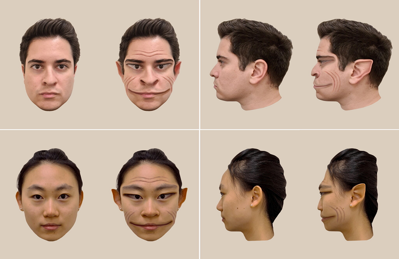 بیماری نادری که باعث می‌شود چهره افراد را شبیه به فیلتر‌های «تیک‌تاک» ببینید! + تصویر